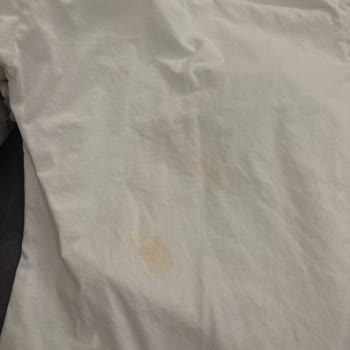 OMO Sıvı Deterjanın Lekeleri Çıkarmaması Ve Yanıltıcı Reklamlar Nedeniyle Ücret İadesi Talebi