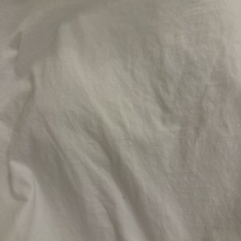 OMO Sıvı Deterjanın Lekeleri Çıkarmaması Ve Yanıltıcı Reklamlar Nedeniyle Ücret İadesi Talebi