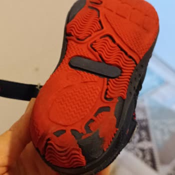 Deforme Bebek Sandaleti İadesi Reddedildi, Alıcı Koruması Yetersiz