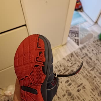 Deforme Bebek Sandaleti İadesi Reddedildi, Alıcı Koruması Yetersiz