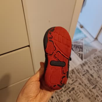 Deforme Bebek Sandaleti İadesi Reddedildi, Alıcı Koruması Yetersiz