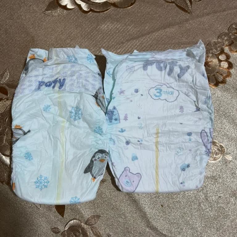 E-Bebek’te Bez Kalitesi Ve İade Sözünün Tutarsızlığı