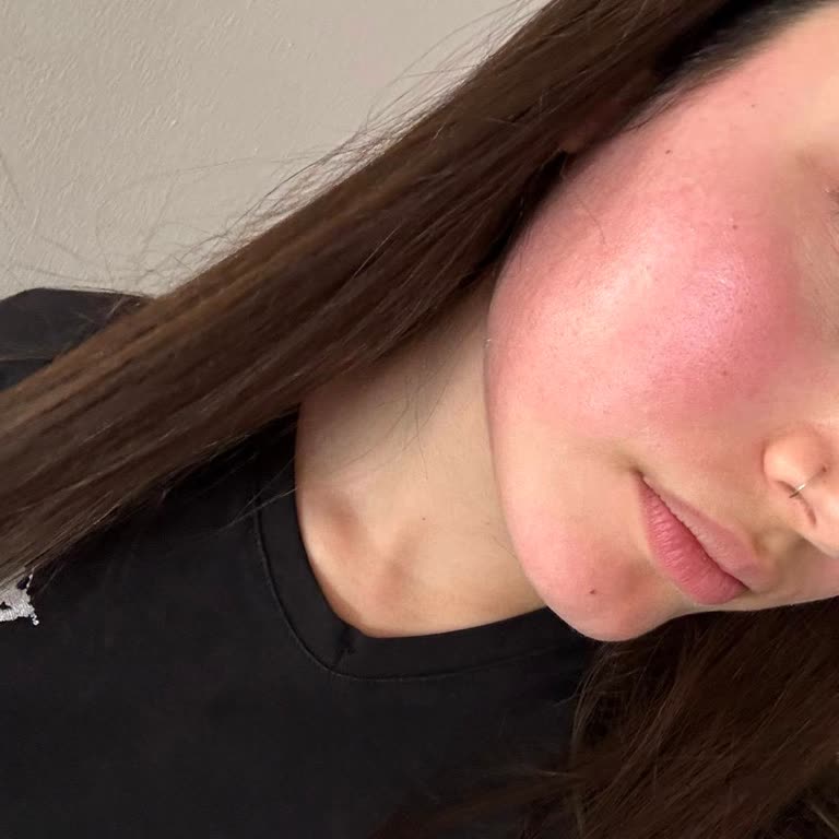 Brimoder Kremi Şiddetli Yanma Ve Kızarıklık Yarattı, İade Talep Edildi