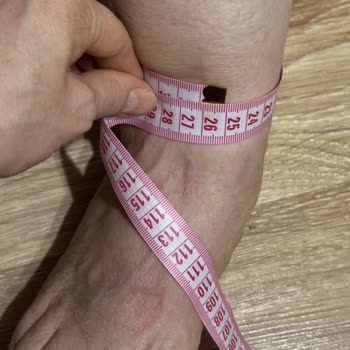 Ayıplı Varimed Çorap Ve Satıcının İade Reddi Ve Tehdit Edici Tutumu