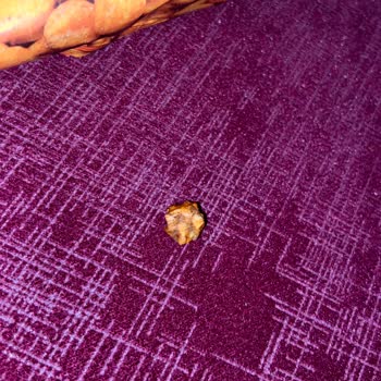 Sert Parça İçeren Simbat Soslu Mısır Çocuğun Dişine Ve Boğazına Tehlike