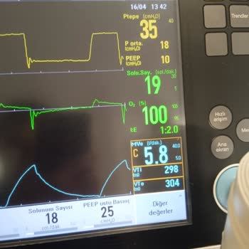 Antalya Eğitim Ve Araştırma Hastanesi'nde Hatalı Entübasyon Ve Annemin Ölümü