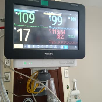 Antalya Eğitim Ve Araştırma Hastanesi'nde Hatalı Entübasyon Ve Annemin Ölümü