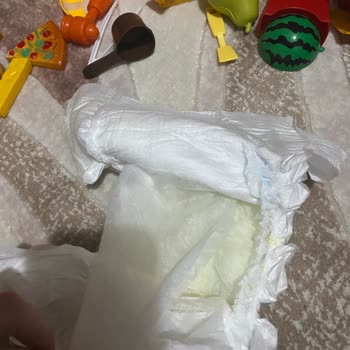 Molfix Bebekte Sızdırma Ve Parçalanma Problemi