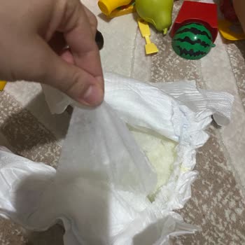 Molfix Bebekte Sızdırma Ve Parçalanma Problemi