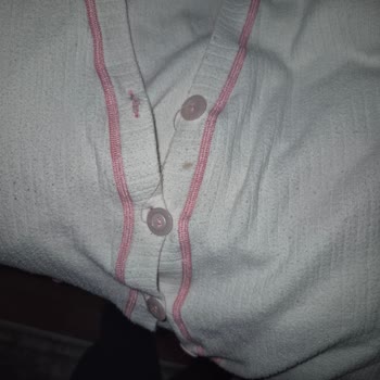 Beko Çamaşır Makinesinin Yıkama Performansı Kötü Para İadesi Talebi