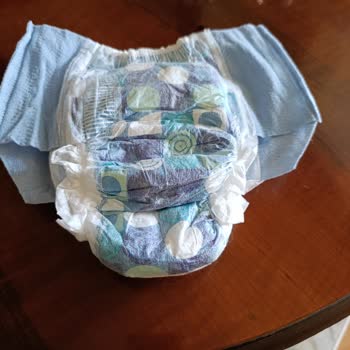 Huggies Kalitesiz Bez Ve Müşteri İletişim İhmali