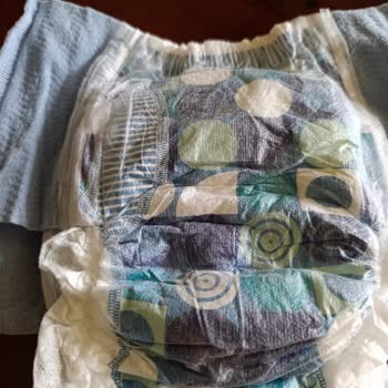 Huggies Kalitesiz Bez Ve Müşteri İletişim İhmali