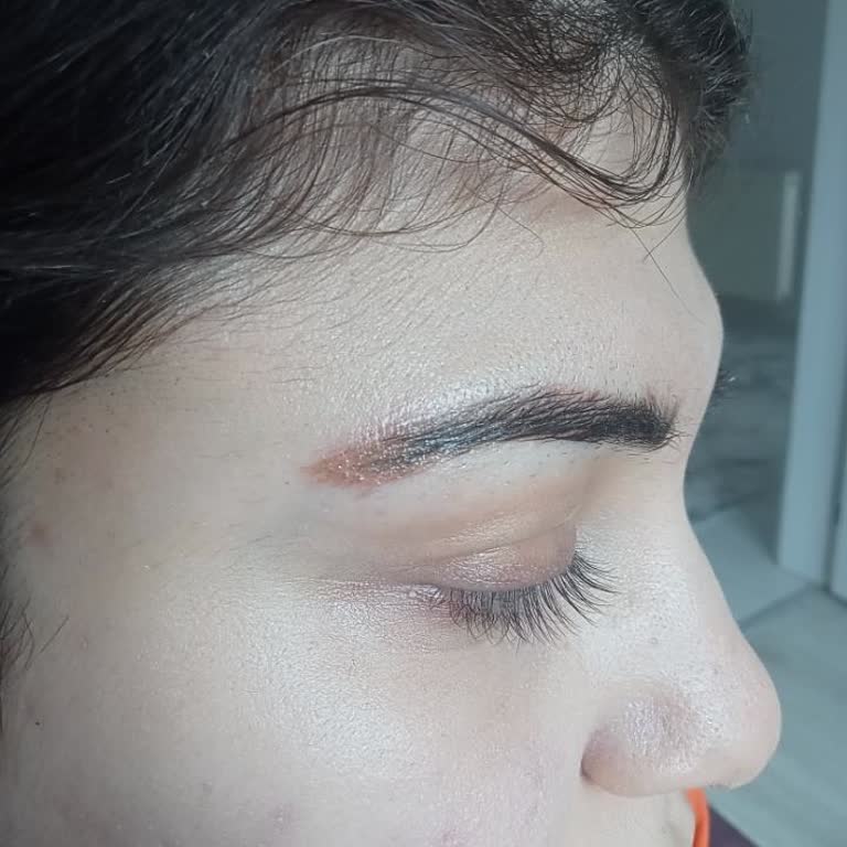 İbrahimli Şubesinde Hatalı Microblading Ve Dudak Renklendirme, İade Talebi