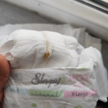 Sleepy Bebek Bezlerinde Sızıntı, İncelik Ve Sert Cisim Sorunu