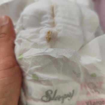 Sleepy Bebek Bezlerinde Sızıntı, İncelik Ve Sert Cisim Sorunu