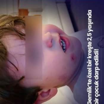 Özel Leyla Işık Kreş & Ana Okulu Yönetimin İhmali Ve Duyarsızlığı