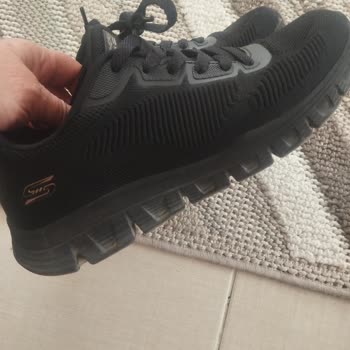 Skechers Ayakkabısındaki Şiddetli Ayak Ağrısı Ve İade Reddi