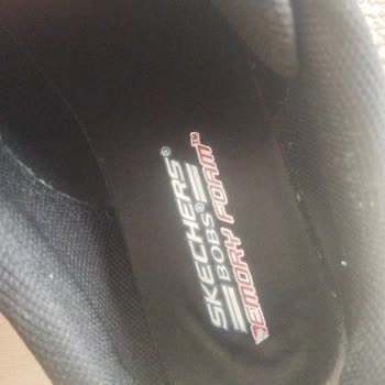Skechers Ayakkabısındaki Şiddetli Ayak Ağrısı Ve İade Reddi