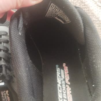 Skechers Ayakkabısındaki Şiddetli Ayak Ağrısı Ve İade Reddi