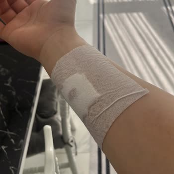 Korkmaz Tavasının Vidalı Parçasının Patlaması Ve Ciddi Kol Yaralanması
