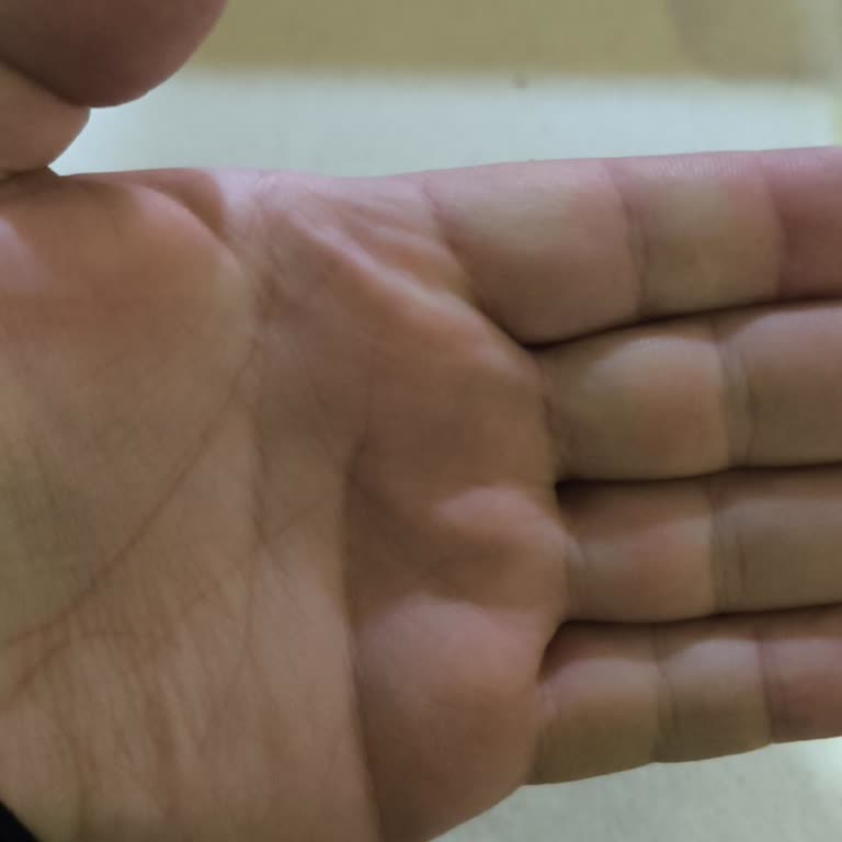 Ziraat Bankası Kartımın Teslim Edilmemesi Ve Hatalı Takip Numarası Nedeniyle Mağduriyet