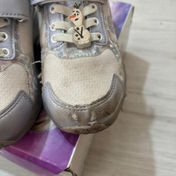 Dayanıksız Çocuk Ayakkabısının İlk Kullanımda Aşırı Hasar Görmesi