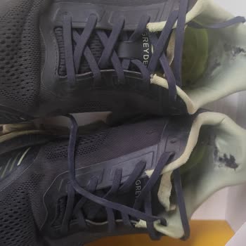 Greyder Spor Ayakkabısındaki Ayıplı Deformasyon Ve Garanti Reddi