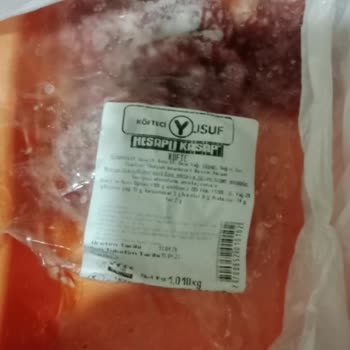 Migros Hemen Köfteci Yusuf'tan Çıkan Demir Parça Çocuğumun Boğazını Tıkadı