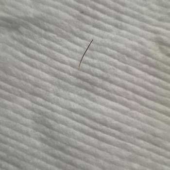 Zel Kelle Paça Çorbasında Hayvan Kılı Bulunması Ve Hijyen İhlali