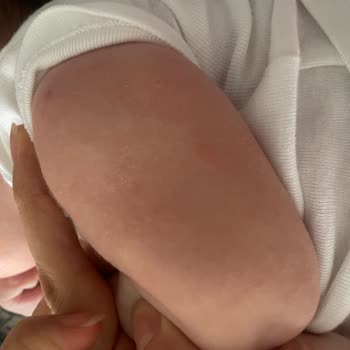 Bebeğimin Cildinde Şampuan Nedeniyle Egzama Oluştu, 712 TL İade Talep Ediyorum