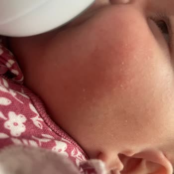 Bebeğimin Cildinde Şampuan Nedeniyle Egzama Oluştu, 712 TL İade Talep Ediyorum