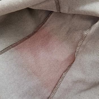 Defolu Ürün Kargo Ücretini Ödemek Zorunda Bırakılması Ve Gecikmeli Yanıt