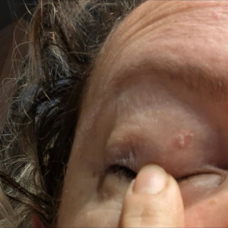 Caudalie Ürünleri Nedeniyle Sedef Hastalığı Ve Şeffaf Olmayan Müşteri Süreci