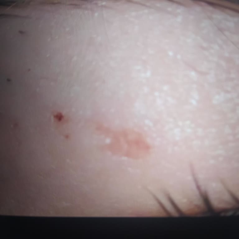 Kaş Alırken Çocuğumun Derisine Yara Açıldı, Ücret İadesi Ve Krem Masrafı Talep Ediyorum