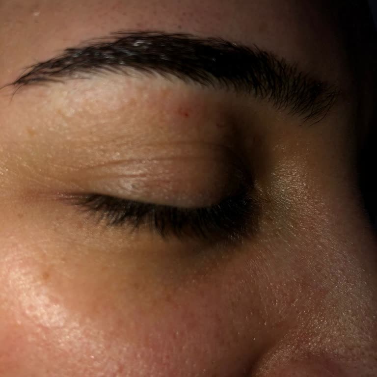 Kaş Aldırma İşleminde Şiddetli Yanma Ve Kanama Nedeniyle Ücret İadesi Talebi