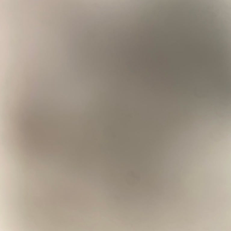 ATM'de Para Yatırma İşlemi Başarısız, 6.100 TL İadesi Acil Olarak Gerekiyor