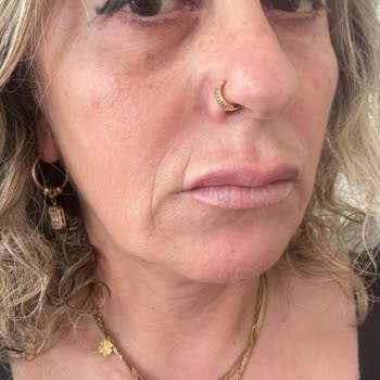 Sözleşme Ve Fatura Verilmemesi, Ayıplı Hizmet Ve Yüzde Çizgi Oluşması Nedeniyle İade Talebi