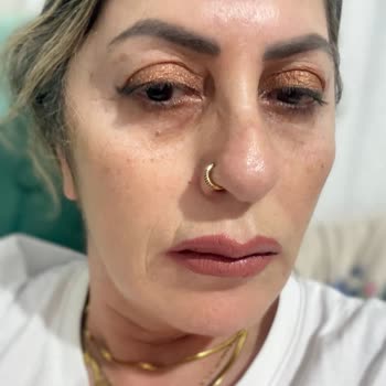 Sözleşme Ve Fatura Verilmemesi, Ayıplı Hizmet Ve Yüzde Çizgi Oluşması Nedeniyle İade Talebi