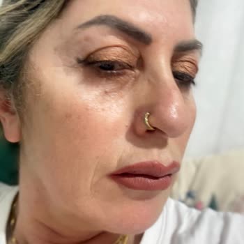 Sözleşme Ve Fatura Verilmemesi, Ayıplı Hizmet Ve Yüzde Çizgi Oluşması Nedeniyle İade Talebi