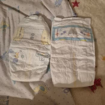 Prima Premium Care Bebek Bezinde Mavi Bel Bariyeri Yok Kalite Sorunu