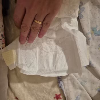 Prima Premium Care Bebek Bezinde Mavi Bel Bariyeri Yok Kalite Sorunu