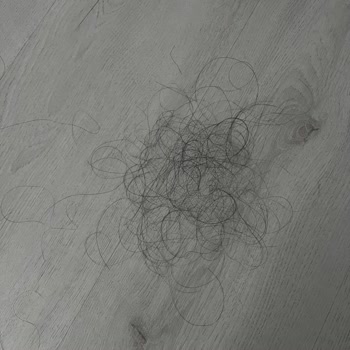 San Kuaför Salon Saç Bakımı Sonrası Şiddetli Saç Dökülmesi Ve İade Talebi