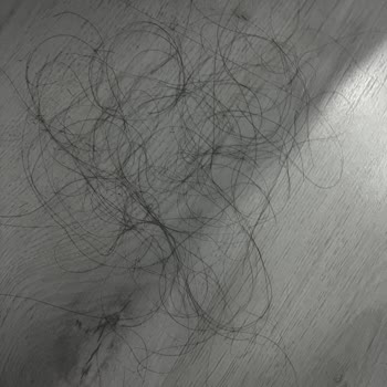 San Kuaför Salon Saç Bakımı Sonrası Şiddetli Saç Dökülmesi Ve İade Talebi