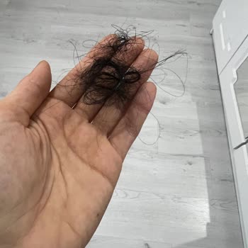 San Kuaför Salon Saç Bakımı Sonrası Şiddetli Saç Dökülmesi Ve İade Talebi