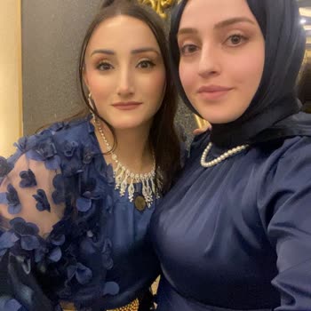 Palette 3.0 Saç Boyasında Yanıltıcı Renk Sonucu Ve Mağduriyet