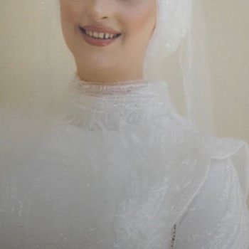 Albüm Renk Bozukluğu Gecikme Ve Yanıltıcı Klip Şikayeti