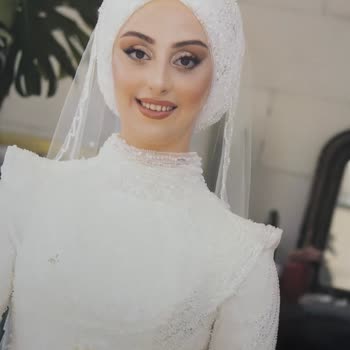 Albüm Renk Bozukluğu Gecikme Ve Yanıltıcı Klip Şikayeti