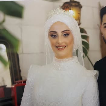 Albüm Renk Bozukluğu Gecikme Ve Yanıltıcı Klip Şikayeti