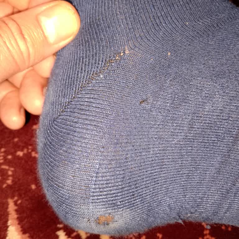 İlk Gün Kullanımda Topuk Yırtılan Bambu Çorap