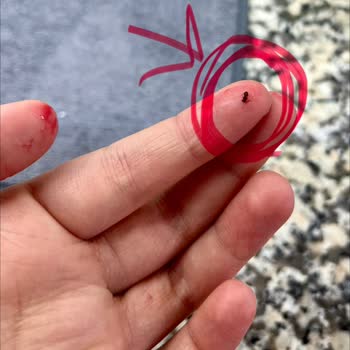 Superfresh Dondurulmuş Frambuazda Böcek Görüldü, Hijyen Ve Güveni Sarsıyor